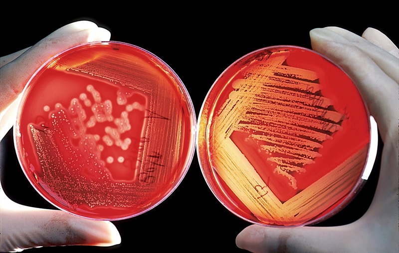 bacteria sipsi 2