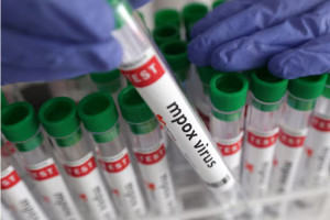 Κίνα: Εντοπίστηκε η νέα παραλλαγή clade 1b του ιού mpox