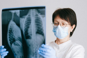 Οι νέες εξελίξεις στην αντιμετώπιση του καρκίνου του πνεύμονα