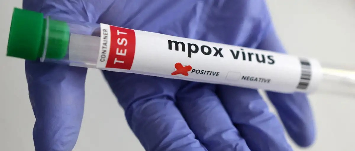 Ιός mpox – Γερμανία: Έκλεισε σχολείο μετά από τον εντοπισμό δύο κρουσμάτων σε παιδιά