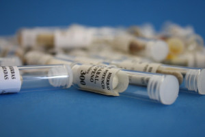 Ορμονική θεραπεία μετά την προστατεκτομή: Ποιους ασθενείς μπορεί να ωφελήσει