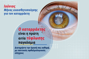 Πρόληψη του καταρράκτη: Ένας οδηγός για υγιή μάτια