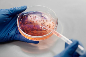 Η μικροβιακή αντοχή προκαλεί 750.000 θανάτους ετησίως που θα μπορούσαν να αποφευχθούν