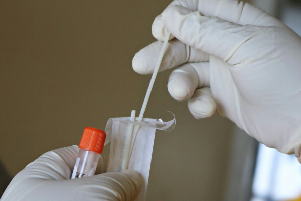 ΕΟΔΥ: Μικρή αύξηση της θετικότητας για RSV – 22 εισαγωγές με κορωνοϊό και 14 με γρίπη