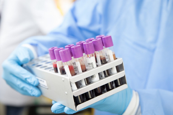 Rusfertide (Mimrylo): «Πράσινο φως» από τον FDA για τον πρώτο μιμητή εψιδίνης για την αληθή πολυκυτταραιμία