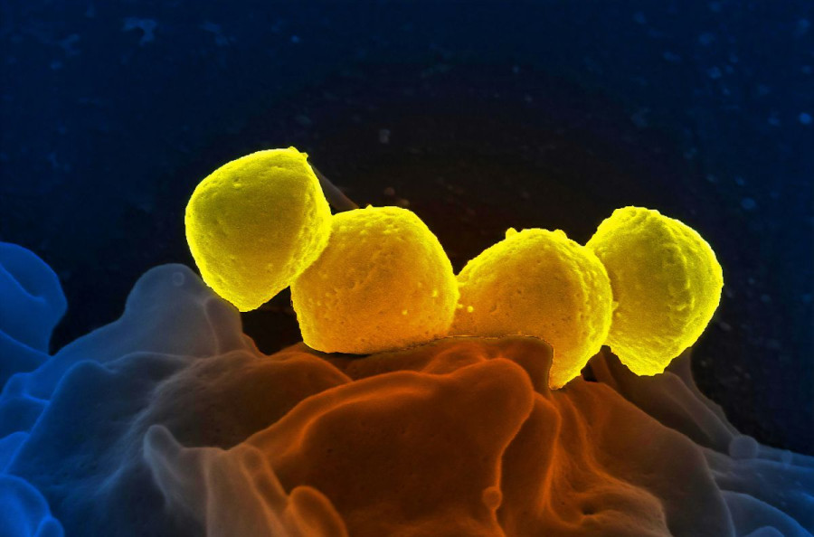 Streptococcus granulicatella adiacens: síntomas y tratamiento de la ...