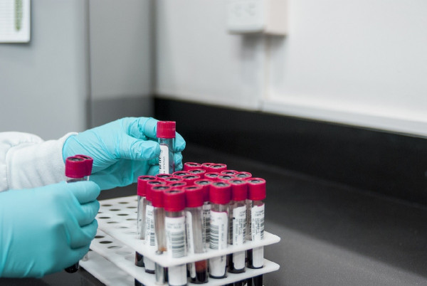 Bristol Myers Squibb: Το nivolumab σε συνδυασμό με AVD έλαβε διευρυμένη έγκριση στην ΕΕ