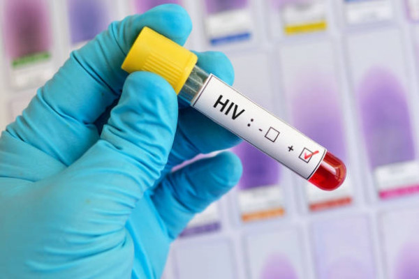 HIV vs. AIDS: Ποια η διαφορά - Όσα πρέπει να γνωρίζουμε